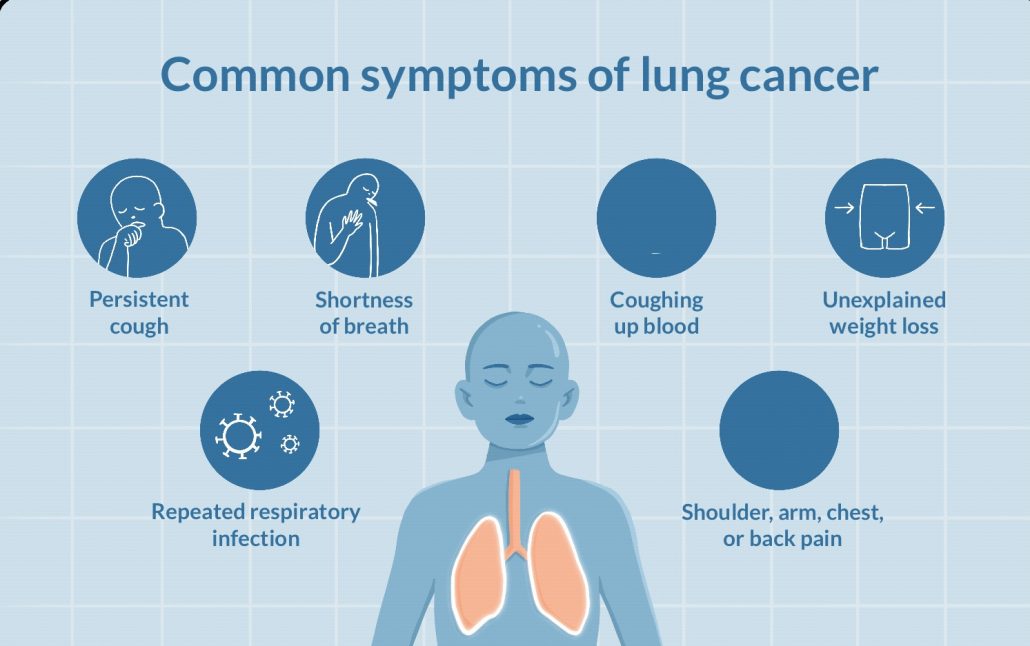 lung cancer2