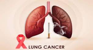 Nursing Care Plans For Lung Cancer